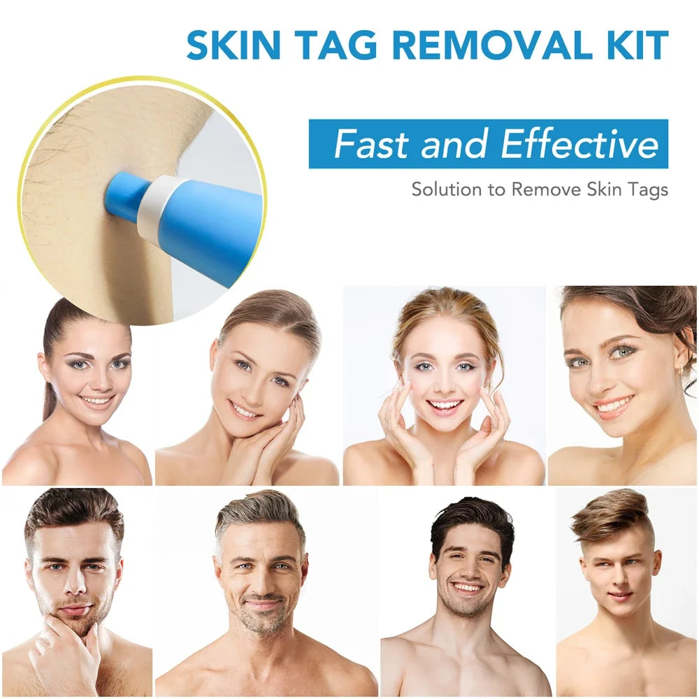 2-in-1 Skin Tag Remover Kit – Micro & Standard Mole/Wart Tool