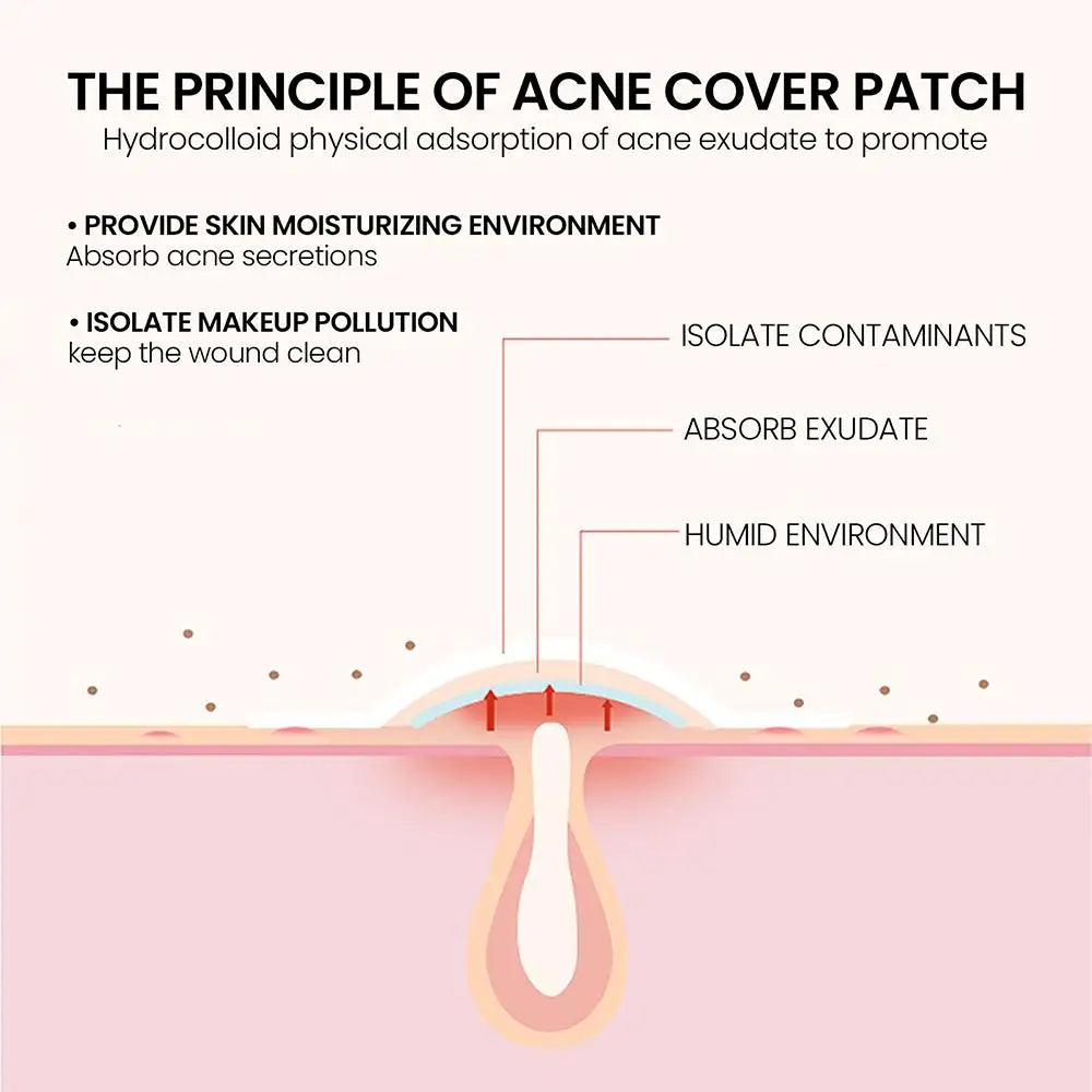 200pcs Colorful Cute Star & Heart Shaped Acne Treatment Stickers – Invisible Pimple Patches for Skincare