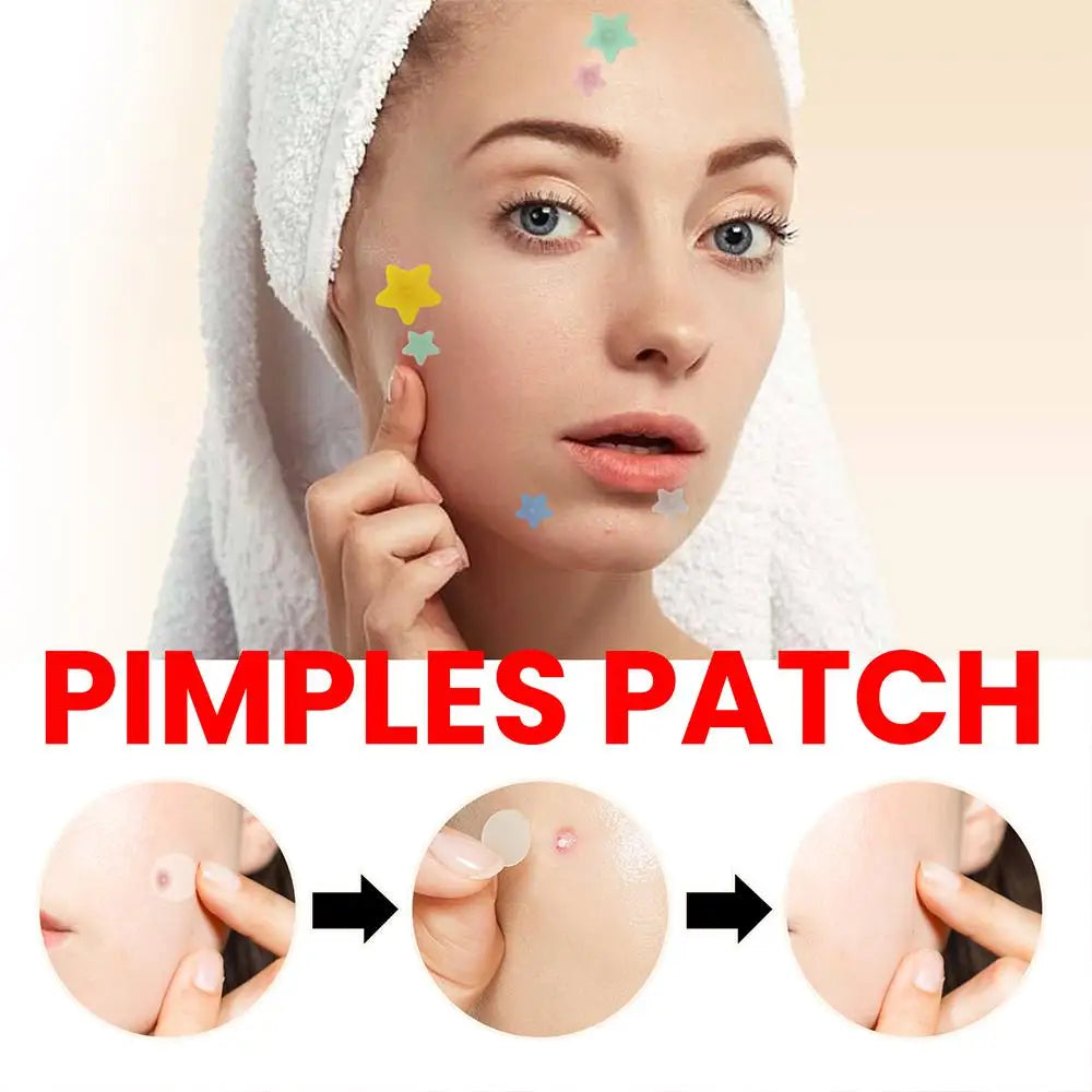 200pcs Colorful Cute Star & Heart Shaped Acne Treatment Stickers – Invisible Pimple Patches for Skincare