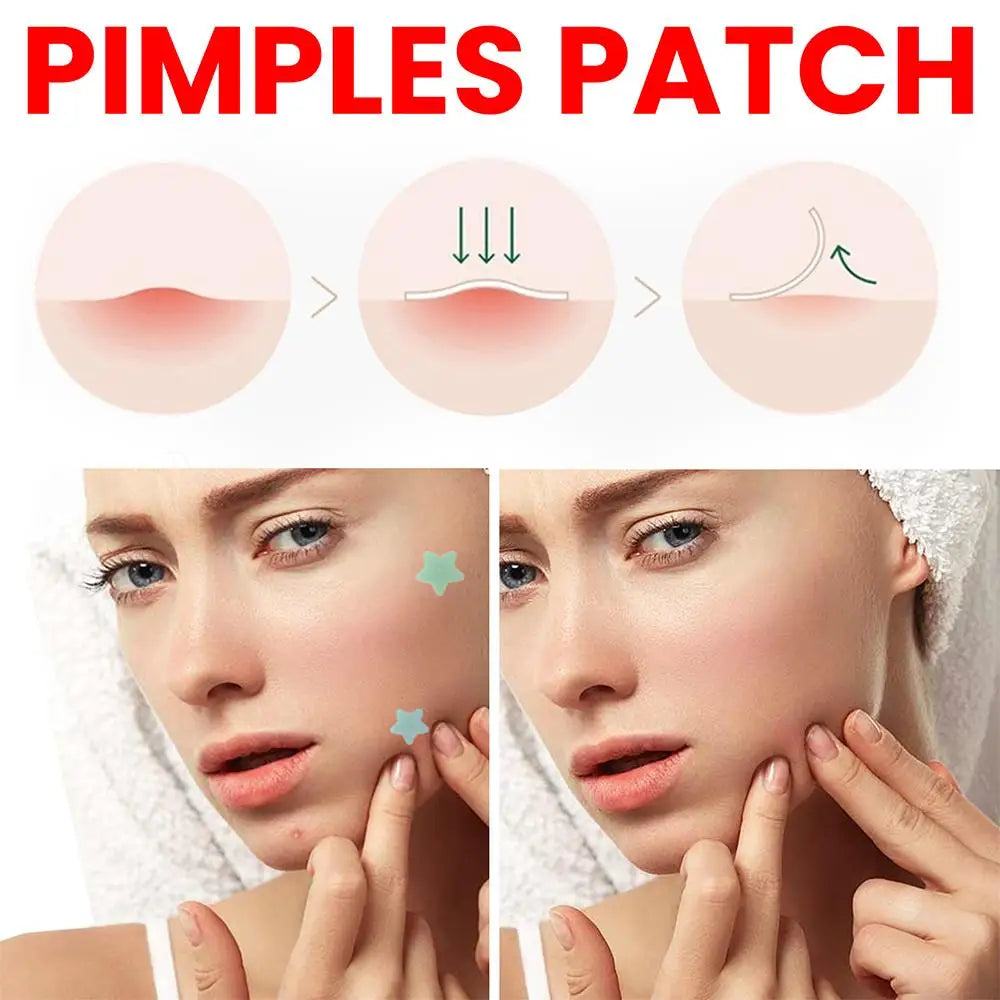 200pcs Colorful Cute Star & Heart Shaped Acne Treatment Stickers – Invisible Pimple Patches for Skincare