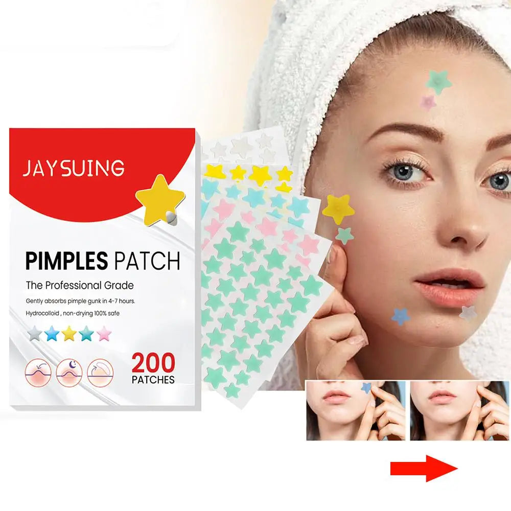 200pcs Colorful Cute Star & Heart Shaped Acne Treatment Stickers – Invisible Pimple Patches for Skincare