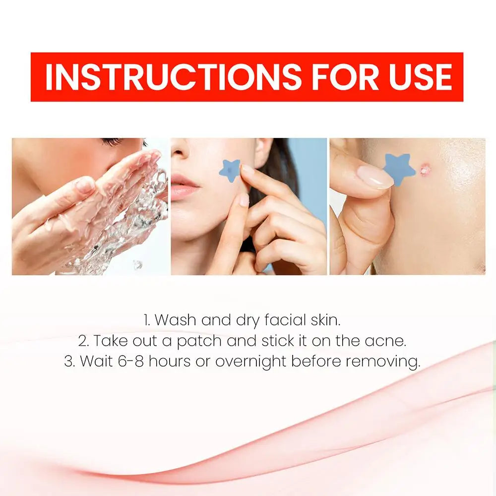 200pcs Colorful Cute Star & Heart Shaped Acne Treatment Stickers – Invisible Pimple Patches for Skincare