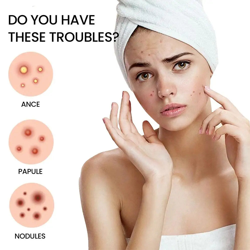 200pcs Colorful Cute Star & Heart Shaped Acne Treatment Stickers – Invisible Pimple Patches for Skincare